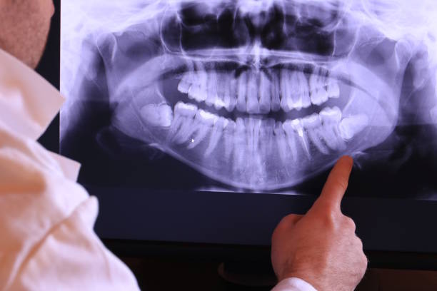 Best Cracked Tooth Emergency Dentist  in Culloden, WV